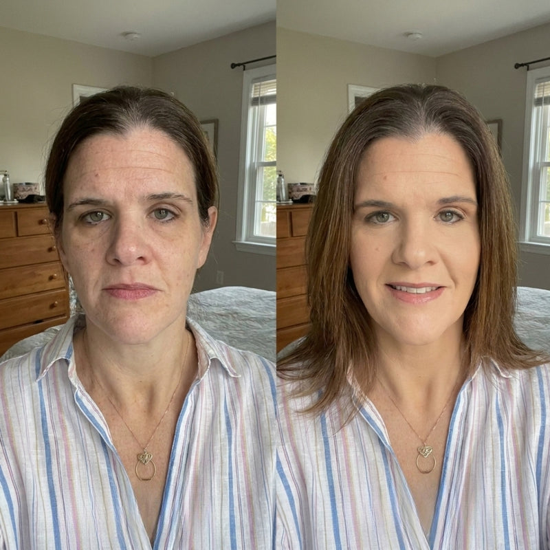 Emily R. before and after