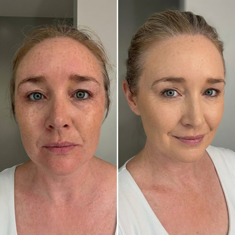 Sarah M. before and after