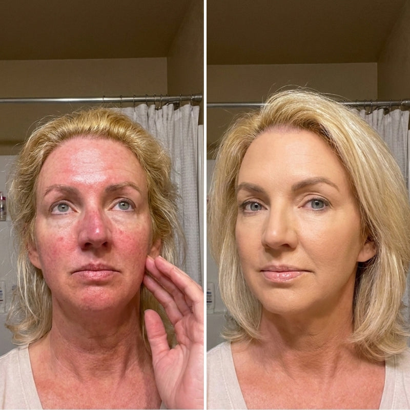 Amanda K. before and after
