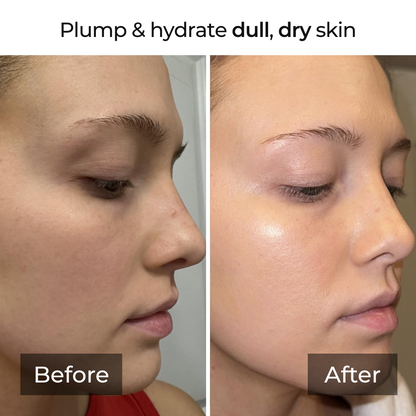 Kojic Acid Turmeric Collagen Overnight Mask